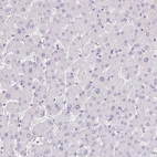 Immunohistochemical staining of human liver shows no positivity in hepatocytes as expected.