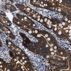 Anti-CBR1 Antibody