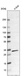 Anti-CBR1 Antibody