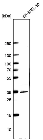 Western blot analysis in human cell line SK-MEL-30.
