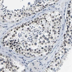 Anti-RANBP2 Antibody