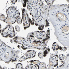 Immunohistochemical staining of human placenta shows strong positivity in nuclear membrane in trophoblastic cells.