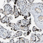 Immunohistochemical staining of human placenta shows strong positivity in nuclear membrane in trophoblastic cells.