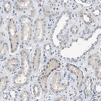 Anti-IPO8 Antibody