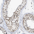 Anti-NUP35 Antibody