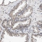 Immunohistochemical staining of human prostate shows strong positivity in nuclear membrane in glandular cells.