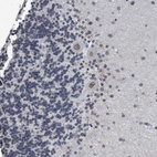 Immunohistochemical staining of human cerebellum shows strong positivity in nuclear membrane in Purkinje cells.