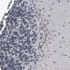 Immunohistochemical staining of human cerebellum shows strong positivity in nuclear membrane in Purkinje cells.