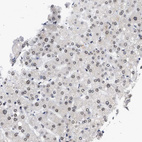 Immunohistochemical staining of human liver shows moderate positivity in nuclear membrane in hepatocytes.