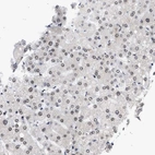 Immunohistochemical staining of human liver shows moderate positivity in nuclear membrane in hepatocytes.