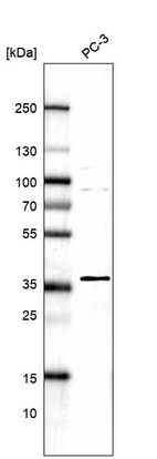 Western blot analysis in human cell line PC-3.