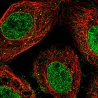 Immunofluorescent staining of human cell line A-431 shows localization to nucleoplasm & nuclear membrane.