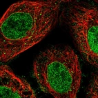 Immunofluorescent staining of human cell line A-431 shows localization to nucleoplasm & nuclear membrane.