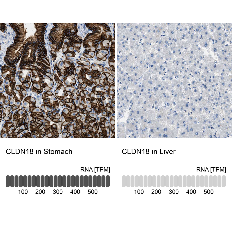 Anti-CLDN18 Antibody