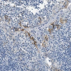 Immunohistochemical staining of human tonsil shows weak to moderate membranous positivity in squamous epithelial cells.