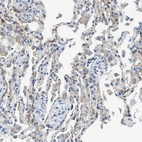 Immunohistochemical staining of human lung shows moderate membranous positivity in pneumocytes.