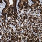 Immunohistochemical staining of human stomach shows strong membranous positivity in glandular cells.
