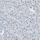 Immunohistochemical staining of human liver shows no positivity in hepatocytes as expected.