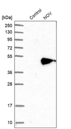 Anti-NOV Antibody