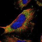 Immunofluorescent staining of human cell line U-251 MG shows localization to vesicles.
