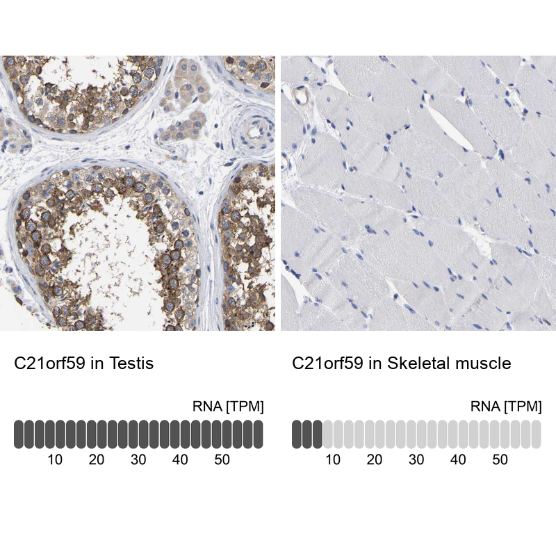 Anti-C21orf59 Antibody