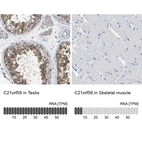 Anti-C21orf59 Antibody