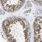 Immunohistochemical staining of human testis shows high expression.