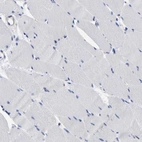 Immunohistochemical staining of human skeletal muscle shows low expression as expected.