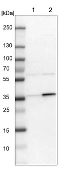 Lane 1: NIH-3T3 cell lysate (Mouse embryonic fibroblast cells)_br/_Lane 2: NBT-II cell lysate (Rat Wistar bladder tumour cells)