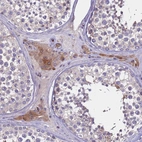 Immunohistochemical staining of human testis shows moderate cytoplasmic positivity in in Leydig cells.