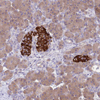 Immunohistochemical staining of human pancreas shows strong cytoplasmic positivity in islets of Langerhans.