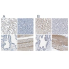 Immunohistochemical staining of human heart muscle, liver, prostate and skeletal muscle using Anti-XIRP1 antibody HPA018458 (A) shows similar protein distribution across tissues to independent antibody HPA016750 (B).