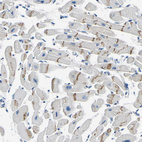 Immunohistochemical staining of human heart muscle shows moderate positivity in intercalated discs.