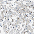 Immunohistochemical staining of human heart muscle shows moderate positivity in intercalated discs.