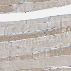 Immunohistochemical staining of human skeletal muscle shows weak to moderate cytoplasmic positivity in myocytes.