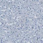 Immunohistochemical staining of human liver shows no positivity in hepatocytes as expected.