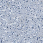 Immunohistochemical staining of human liver shows no positivity in hepatocytes as expected.
