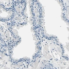 Immunohistochemical staining of human prostate shows no positivity in glandular cells as expected.