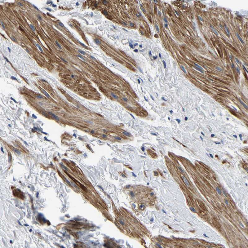 Anti-KCTD17 Antibody