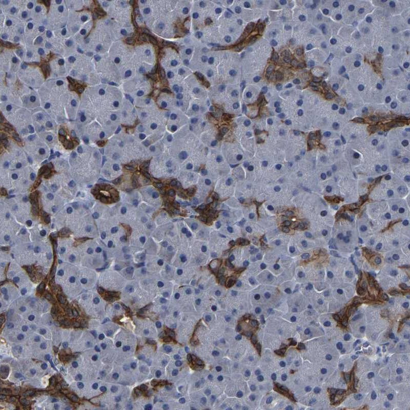 Anti-DSCR4 Antibody