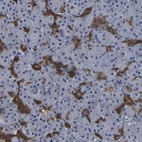 Anti-DSCR4 Antibody