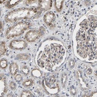 Anti-TMEM38B Antibody
