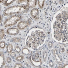 Anti-TMEM38B Antibody