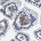 Immunohistochemical staining of human small intestine shows moderate membranous/cytoplasmic positivity in lymphoid cells.