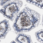 Immunohistochemical staining of human small intestine shows moderate membranous/cytoplasmic positivity in lymphoid cells.