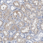 Immunohistochemical staining of human kidney shows moderate membranous/cytoplasmic positivity in cells in tubules.