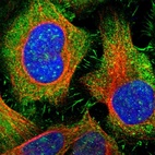 Immunofluorescent staining of human cell line U-2 OS shows positivity in nucleus, plasma membrane & cytoplasm.