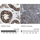 Anti-PDCD5 Antibody