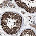 Immunohistochemical staining of human testis shows high expression.