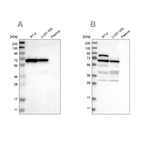 Western blot analysis using Anti-NOP58 antibody HPA018472 (A) shows similar pattern to independent antibody HPA021062 (B).